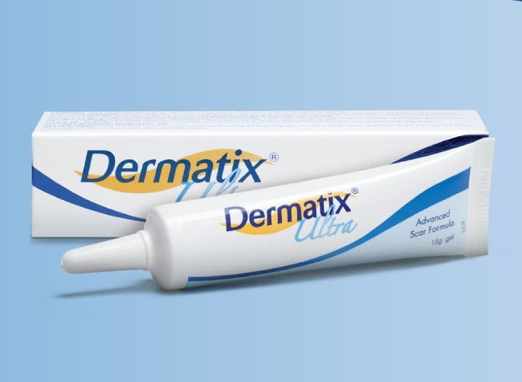 Dermatix - Trị sẹo mổ đẻ tốt nhất hiện nay
